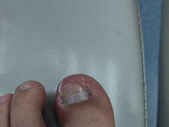 -新甲连锁灰指甲·甲沟炎·鸡眼(黑龙江路店)