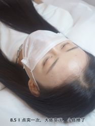 -清疣美疣·痣·斑净肤中心