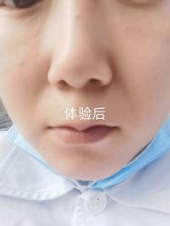 -成都艾特他整形外科医院