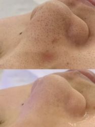 -春田皮肤管理中心品牌旗舰店