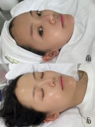 -凡碧诗毛孔清洁收细