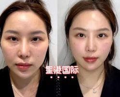 -星港国际·Skin皮肤专研·皮肤管理