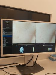 -苑苑vbeauty科技美容SPA