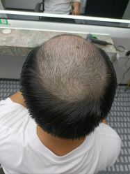 -唐风采假发补发定制