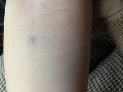 -苏州市立医院(白塔院区)