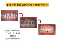 -团圆口腔·种植中心(锦江院区)