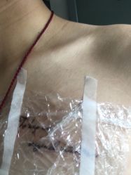 -V一刺青·纹身   穿孔    清洗