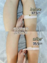 -Lily纤美·科技减脂中心