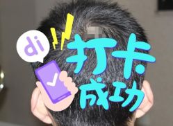 -大麦微针植发全国连锁
