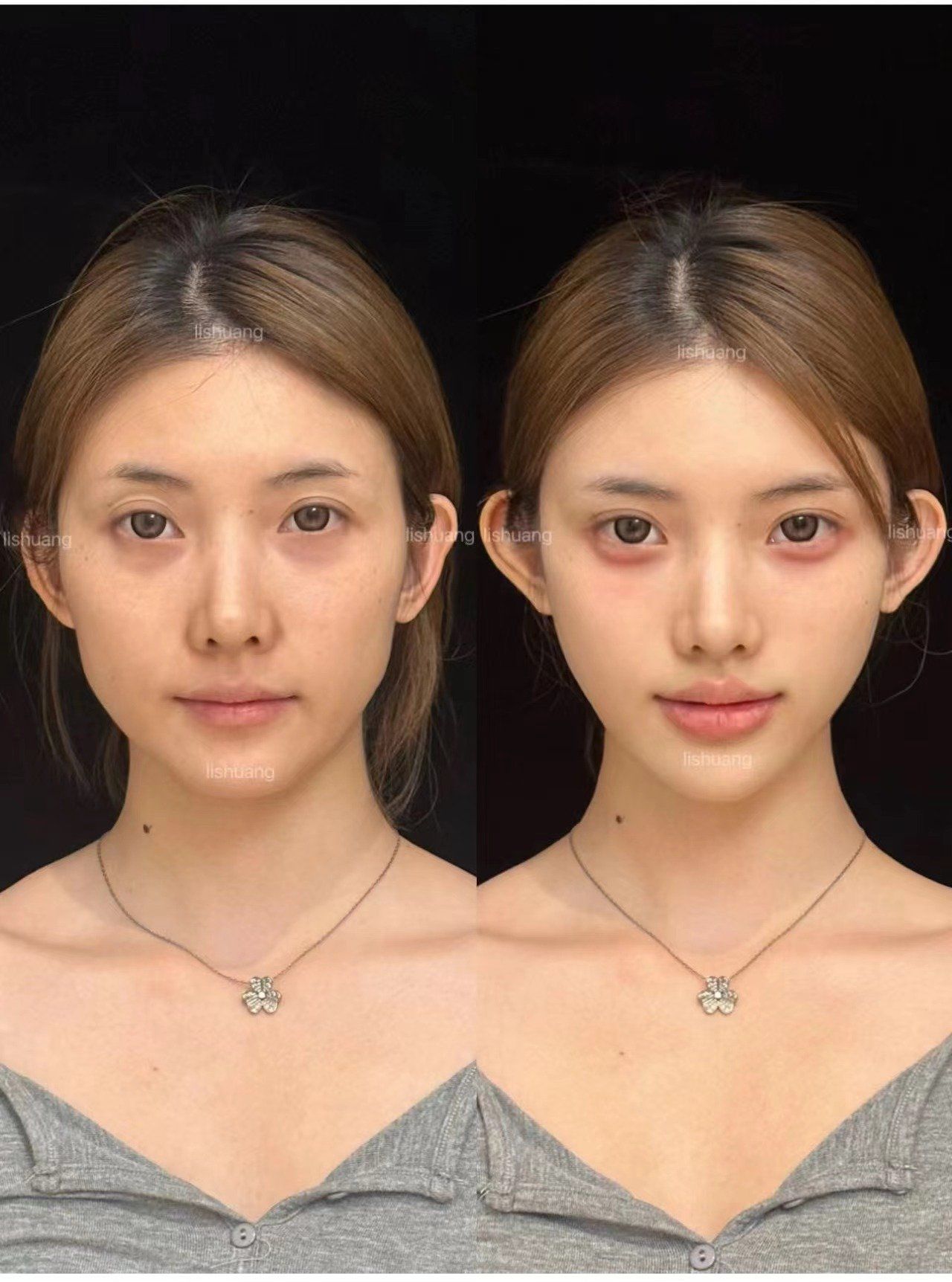 微调才是王炸 垮脸爆改后太喜欢这张脸了