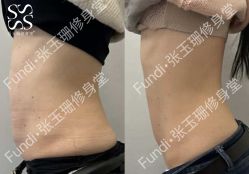 -Fundi张玉珊修身堂·indiba·BTL科技瘦身
