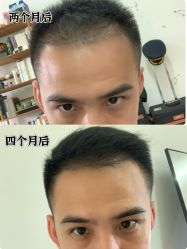 -雍禾植发全国连锁