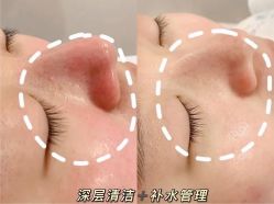 -美肤盾祛痘·问题肌头疗管理中心