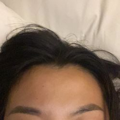 体验后-南昌艾莱芙美容医院