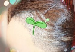 -大麦微针植发全国连锁