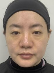 -天津健丽·去眼袋医疗美容机构