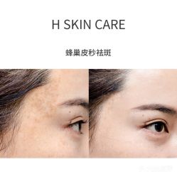 -美壹生诊所皮肤管理中心·海菲秀&Legacy美白舱