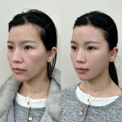 点击看大图 -Yestar艺星医疗美容医院