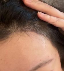 -熙朵美学植发·连锁品牌