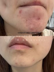 点击看大图 -MLP美丽派·问题肌疗愈中心