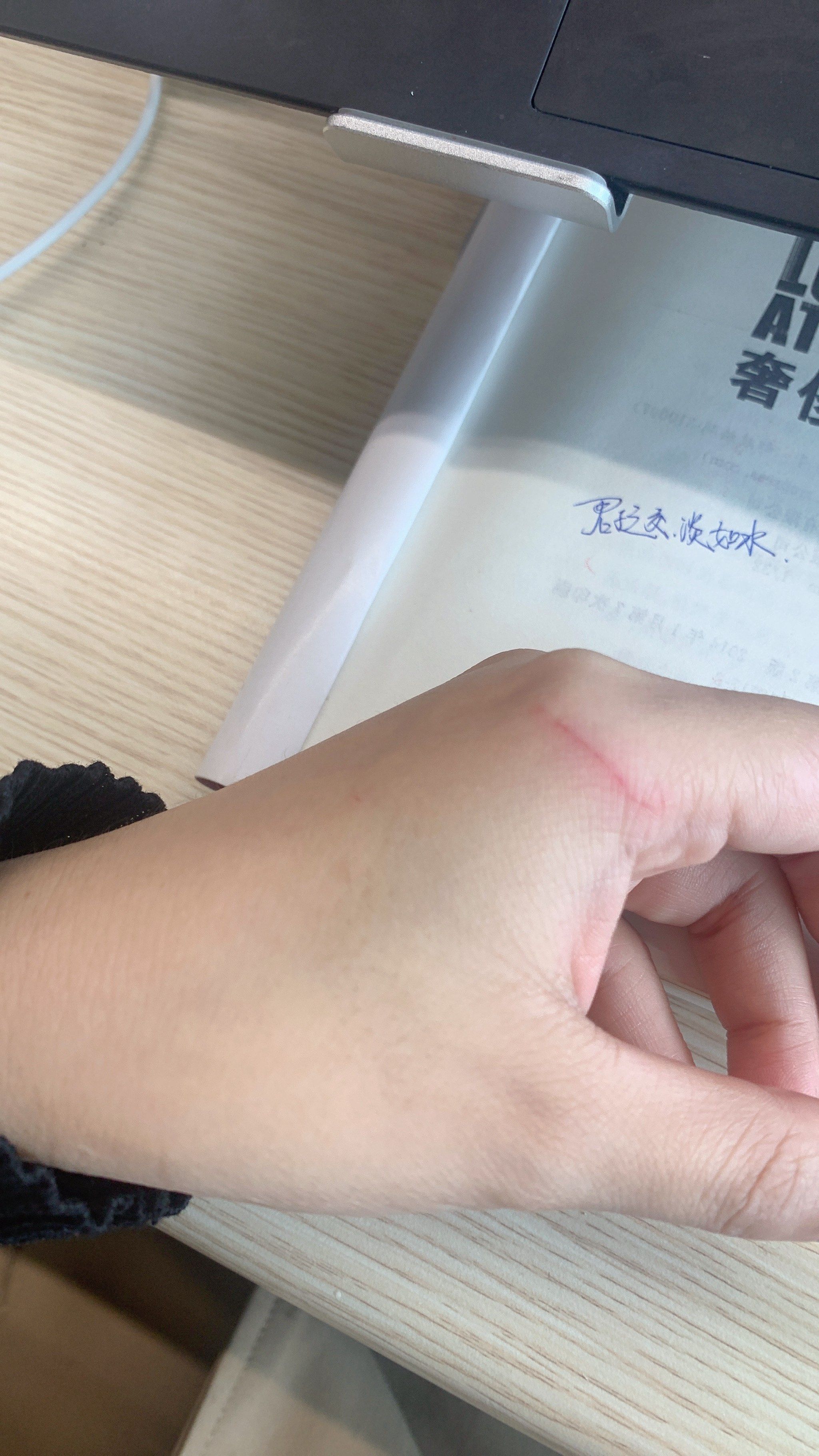 被我家赤赤抓破了手皮