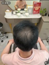 -唐风采假发补发定制