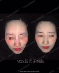 -E.beauty驻颜·痘敏肌调理中心