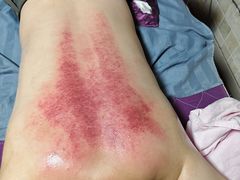 -沈师傅盲人按摩工作室(密三小区店)