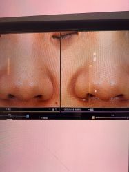 -苑苑vbeauty科技美容SPA