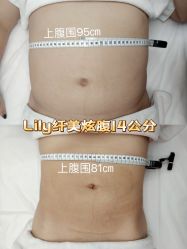 -Lily纤美·科技减脂中心