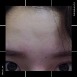 体验后-重庆军美医疗美容医院