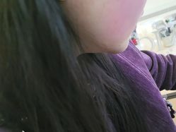 -四川米兰柏羽医学美容医院