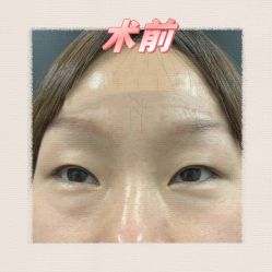 -素美医疗美容·西南眼鼻整形·修复基地