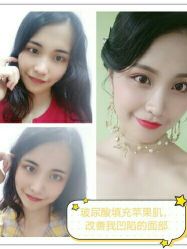 -广东韩妃整形外科医院