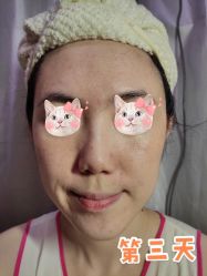 -洁铭新加坡医美