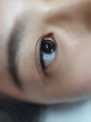 -宥莉·ULLY 痘敏肌•科技皮肤管理中心