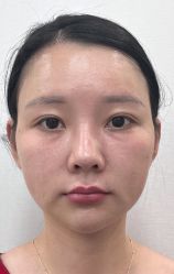 -广州曙光医学美容医院