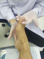 -派恩宜灰指甲鸡眼嵌甲手足癣