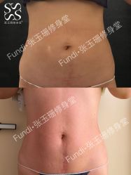 -Fundi张玉珊修身堂·indiba·BTL科技瘦身