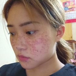 点击看大图 -AIST爱思特医疗美容医院