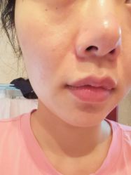 体验前-美莱医学美容医院