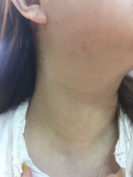 体验后-原力医疗美容