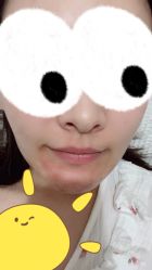 体验后-纯粹医美