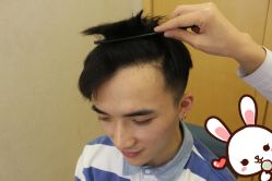 点击看大图 -大麦微针植发丨全国连锁