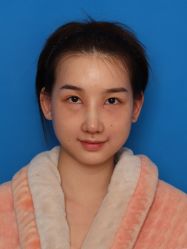 体验后-南宁华美医疗美容医院