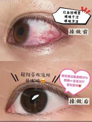 -LUNA皮相美·骨相美高级美感