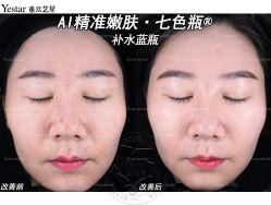 -Yestar重庆艺星医疗美容医院