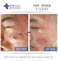 -苗方清颜痘肌研究所