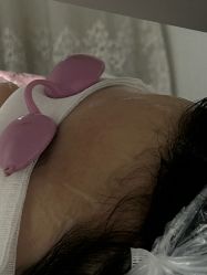 -长沙雅美医疗美容医院
