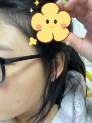 体验前-澳尔颜选医疗美容